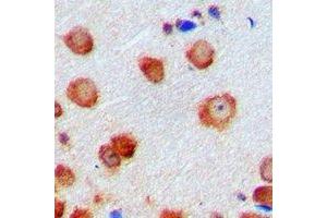 Immunohistochemical analysis of CDK6 staining in human brain formalin fixed paraffin embedded tissue section. (CDK6 抗体)