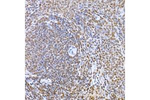 Immunohistochemistry of paraffin-embedded rat spleen using Snail Rabbit pAb (ABIN1682836, ABIN3019402, ABIN3019403, ABIN3019404 and ABIN6220883) at dilution of 1:150 (40x lens). (SNAIL 抗体  (AA 1-100))