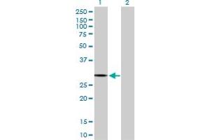 Western Blot analysis of PACRG expression in transfected 293T cell line by PACRG MaxPab polyclonal antibody. (PACRG 抗体  (AA 1-257))