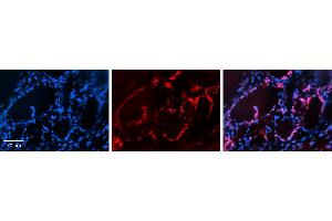 Rabbit Anti-PAX8 Antibody Catalog Number: ARP34180_P050 Formalin Fixed Paraffin Embedded Tissue: Human Thyroid Tissue Observed Staining: Nucleus in follicular cells Primary Antibody Concentration: N/A Other Working Concentrations: 1:600 Secondary Antibody: Donkey anti-Rabbit-Cy3 Secondary Antibody Concentration: 1:200 Magnification: 20X Exposure Time: 0.