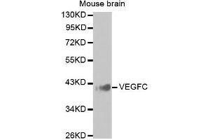 Western Blotting (WB) image for anti-Vascular Endothelial Growth Factor C (VEGFC) antibody (ABIN6219656) (VEGFC 抗体)