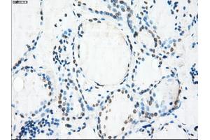Immunohistochemical staining of paraffin-embedded Ovary tissue using anti-CRYABmouse monoclonal antibody. (CRYAB 抗体)