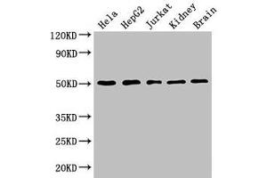 Western Blot Positive WB detected in: Hela whole cell lysate, HepG2 whole cell lysate, Jurkat whole cell lysate, Mouse kidney tissue, Mouse brain tissue All lanes: TUBA3C antibody at 3 μg/mL Secondary Goat polyclonal to rabbit IgG at 1/50000 dilution Predicted band size: 50, 47 kDa Observed band size: 50 kDa (TUBA3C 抗体  (AA 161-418))