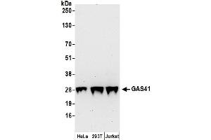 anti-YEATS Domain Containing 4 (AA 177-227) antibody