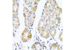 Immunohistochemistry of paraffin-embedded human stomach using MRPL11 antibody. (MRPL11 抗体  (AA 1-192))