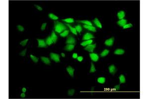 Immunofluorescence of monoclonal antibody to SGTA on HeLa cell. (SGTA 抗体  (AA 42-123))