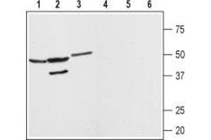 Western blot analysis of rat brain (lanes 1 and 4) kidney (lanes 2 and 5) and heart (lanes 3 and 6) membranes: - 1-3. (MAS1 抗体  (AA 212-224))