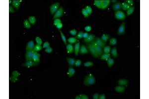 Immunofluorescence staining of PC-3 cells with ABIN7162284 at 1:166, counter-stained with DAPI. (ORMDL3 抗体  (AA 43-94))