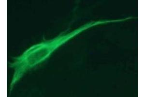Immunofluorescence (IF) image for anti-Glial Fibrillary Acidic Protein (GFAP) antibody (ABIN1449150) (GFAP 抗体)