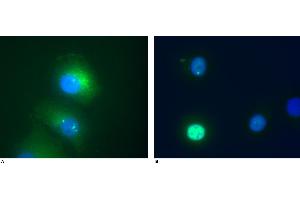 Immunocytochemistry staining of Daxx in transfected HeLa human cervix carcinoma cell line. (DAXX 抗体  (AA 558-740))