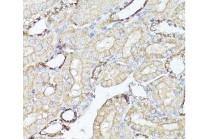 Immunohistochemistry of paraffin-embedded Mouse kidney using OPRK1 Polyclonal Antibody at dilution of 1:100 (40x lens). (OPRK1 抗体)