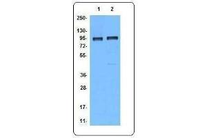 Western Blotting (WB) image for anti-B-Cell CLL/lymphoma 6 (BCL6) antibody (ABIN2664064) (BCL6 抗体)