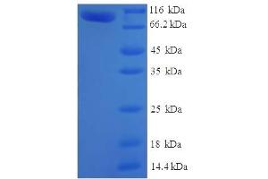 SDS-PAGE (SDS) image for Myotubularin Related Protein 7 (MTMR7) (AA 1-660), (full length) protein (His-SUMO Tag) (ABIN5711977)