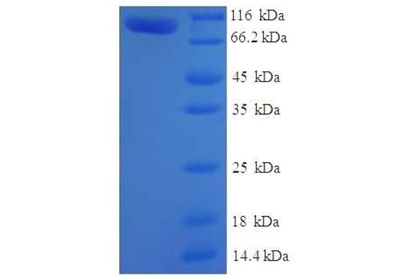 MTMR7 Protein (AA 1-660, full length) (His-SUMO Tag)