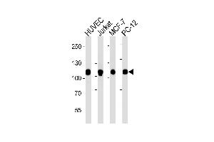 Western blot analysis of lysates from HUVEC, Jurkat, MCF-7, PC-12 cell line (from left to right), using TOP1 Antibody (N-term) (ABIN1882055 and ABIN2838496). (Topoisomerase I 抗体  (N-Term))
