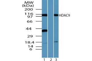 Image no. 2 for anti-Histone Deacetylase 9 (HDAC9) (AA 100-150) antibody (ABIN960197) (HDAC9 抗体  (AA 100-150))