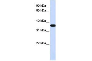 Heme Oxygenase antibody used at 1 ug/ml to detect target protein. (Heme Oxygenase 抗体)
