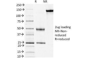 SDS-PAGE Analysis Purified CD3e Mouse Monoclonal Antibody (PC3/188A). (CD3 epsilon 抗体  (Cytoplasmic Domain))
