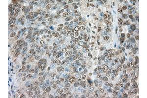 Immunohistochemical staining of paraffin-embedded colon tissue using anti-TACC3 mouse monoclonal antibody. (TACC3 抗体)