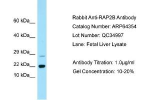 Western Blotting (WB) image for anti-RAP2B, Member of RAS Oncogene Family (RAP2B) (C-Term) antibody (ABIN2789814)