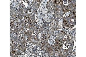 IHC analysis of SEC14L3/TAP2 using anti-SEC14L3/TAP2 antibody (ABIN7601623).