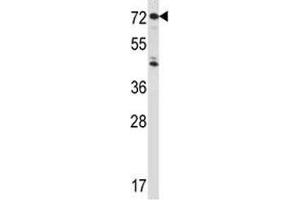 IL1R1 antibody western blot analysis in HepG2 lysate.