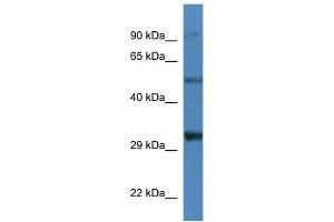 WB Suggested Anti-Sgcd Antibody   Titration: 1. (SGCD 抗体  (N-Term))