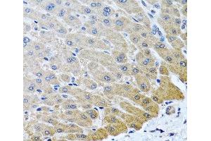 Immunohistochemistry of paraffin-embedded Human liver using ARSF Polyclonal Antibody at dilution of 1:100 (40x lens). (ARSF 抗体)