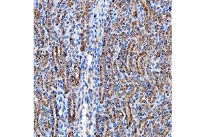 IHC analysis of RAB7/RAB7A using anti-RAB7/RAB7A antibody (ABIN7600597). (RAB7A 抗体  (AA 21-177))