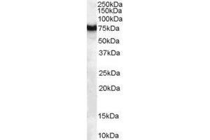 ABIN2562711 (1µg/ml) staining of human pancreas lysate (35µg protein in RIPA buffer). (FZD8 抗体  (C-Term))