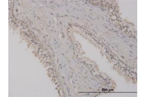 Immunoperoxidase of monoclonal antibody to ST8SIA2 on formalin-fixed paraffin-embedded human prostate. (ST8SIA2 抗体  (AA 40-146))