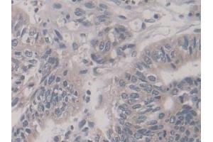 Immunohistochemistry (IHC) image for anti-Kinesin Family Member 18A (KIF18A) (AA 1-453) antibody (ABIN7436060)