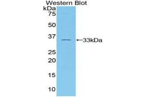 Western blot analysis of the recombinant protein. (TUBB1 抗体  (AA 182-437))