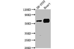 Western Blot Positive WB detected in: SH-SY5Y whole cell lysate, Mouse heart tissue All lanes: JRK antibody at 1:1000 Secondary Goat polyclonal to rabbit IgG at 1/50000 dilution Predicted band size: 62, 63 kDa Observed band size: 62 kDa (JRK 抗体  (AA 465-483))