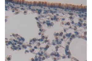 Detection of ATM in Mouse Lung Tissue using Polyclonal Antibody to Ataxia Telangiectasia Mutated (ATM) (ATM 抗体  (AA 486-742))