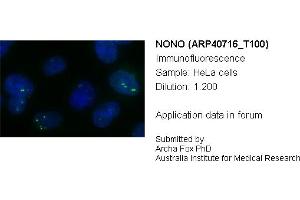 Image no. 6 for anti-Non-POU Domain Containing, Octamer-Binding (NONO) (C-Term) antibody (ABIN2779028)