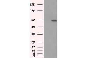 Image no. 1 for anti-Protein Phosphatase 5, Catalytic Subunit (PPP5C) antibody (ABIN1500392) (PP5 抗体)