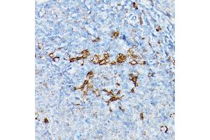Immunohistochemistry of paraffin-embedded rat spleen using STING antibody (ABIN7270958) at dilution of 1:25 (40x lens). (STING/TMEM173 抗体)