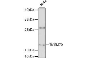 Western blot analysis of extracts of HeLa cells, using TMEM70 antibody (ABIN6294170) at 1:3000 dilution. (Transmembrane Protein 70 (TMM70) 抗体)