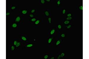 Immunofluorescent analysis of Hela cells using ABIN7142846 at dilution of 1:100 and Alexa Fluor 488-congugated AffiniPure Goat Anti-Rabbit IgG(H+L) (NIP7 抗体  (AA 1-180))