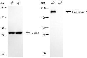 Western blotting analysis using polybromo 1 antibody (ABIN7799873). (Recombinant Polybromo 1 抗体)