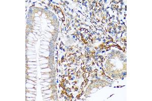 Immunohistochemistry of paraffin-embedded human appendix using Sec23AA Rabbit mAb (ABIN7270168) at dilution of 1:100 (40x lens). (SEC23A 抗体)