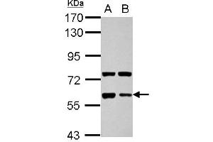 Western Blotting (WB) image for anti-Glypican 5 (GPC5) (AA 37-352) antibody (ABIN1498501) (GPC5 抗体  (AA 37-352))