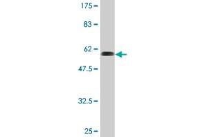 Western Blot detection against Immunogen (61. (Ribokinase 抗体  (AA 1-322))