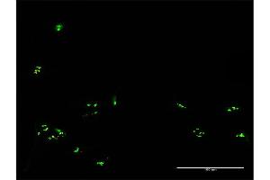 Immunofluorescence of purified MaxPab antibody to RBM19 on HeLa cell. (RBM19 抗体  (AA 1-960))