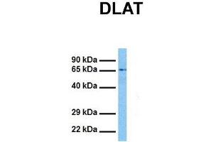 Host:  Rabbit  Target Name:  DLAT  Sample Tissue:  Human Jurkat  Antibody Dilution:  1. (DLAT 抗体  (N-Term))