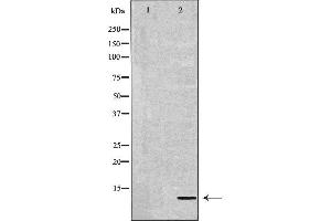 Western blot analysis of Mouse liver lysate, using DEFB132 Antibody. (DEFB132 抗体)