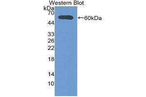 Western Blotting (WB) image for anti-Deiodinase, Iodothyronine, Type II (DIO2) (AA 30-259) antibody (ABIN1858636) (DIO2 抗体  (AA 30-259))
