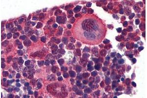 Mouse Lymphoid Tissue: Formalin-Fixed, Paraffin-Embedded (FFPE) (NK2 Homeobox 3 抗体  (AA 281-330))
