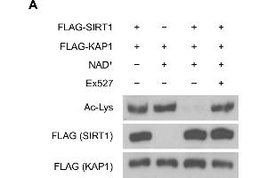 SIRT1 deacetylates KAP1 in vitro and in vivo. (Acetylated Lysine 抗体)